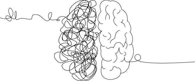 Ilustración de un cerebro